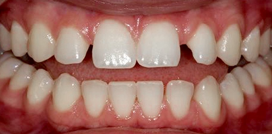 On-Track-Dental-dentist-Rosanna-Melbourne-results-03a On-Track-Dental-dentist-Rosanna-Melbourne-results-03a