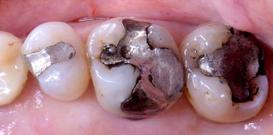 On-Track-Dental-dentist-Rosanna-Melbourne-results-06a On-Track-Dental-dentist-Rosanna-Melbourne-results-06a