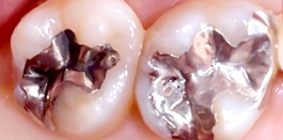 On-Track-Dental-dentist-Rosanna-Melbourne-results-07a On-Track-Dental-dentist-Rosanna-Melbourne-results-07a
