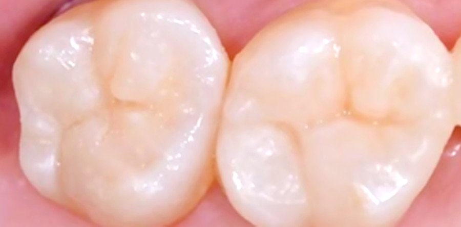 On-Track-Dental-dentist-Rosanna-Melbourne-results-07b