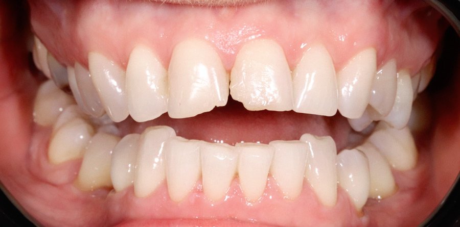 On-Track-Dental-dentist-Rosanna-Melbourne-results-12a-1
