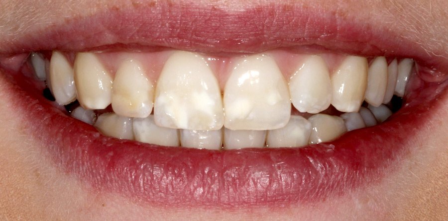 On-Track-Dental-dentist-Rosanna-Melbourne-results-17a On-Track-Dental-dentist-Rosanna-Melbourne-results-17a