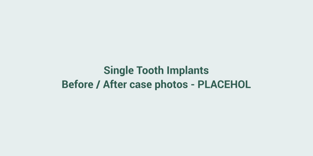 Placeholder for before and after case photos