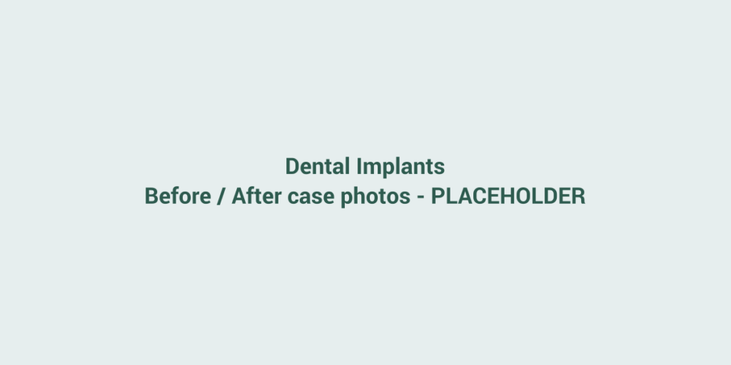 Placeholder for before and after case photos
