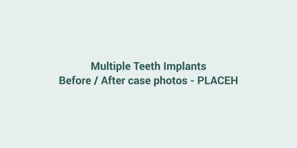 Placeholder for before and after case photos