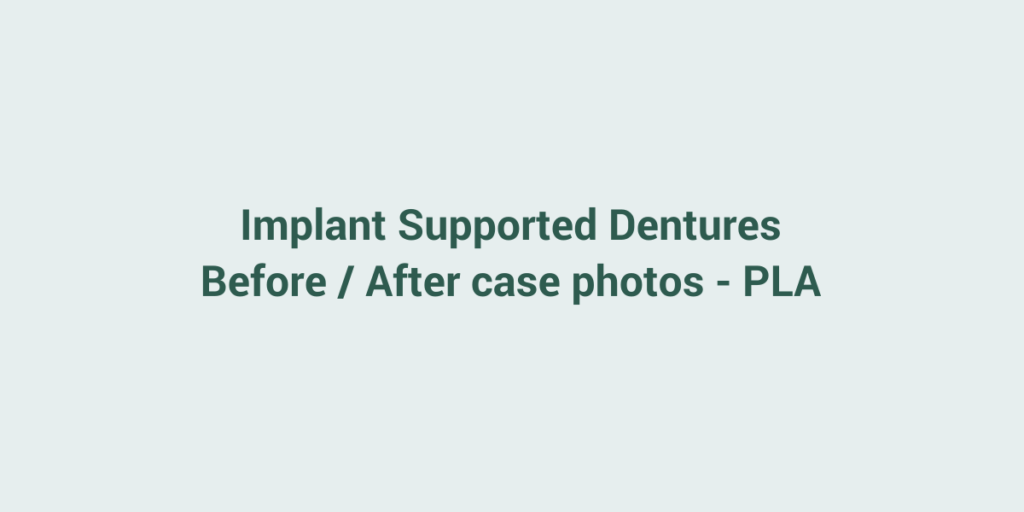 Placeholder for before and after case photos