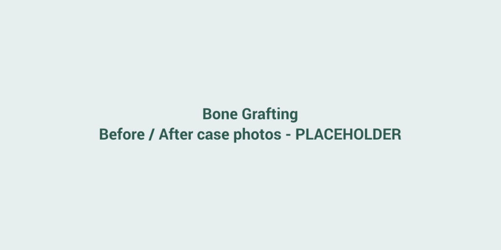 Placeholder for before and after case photos
