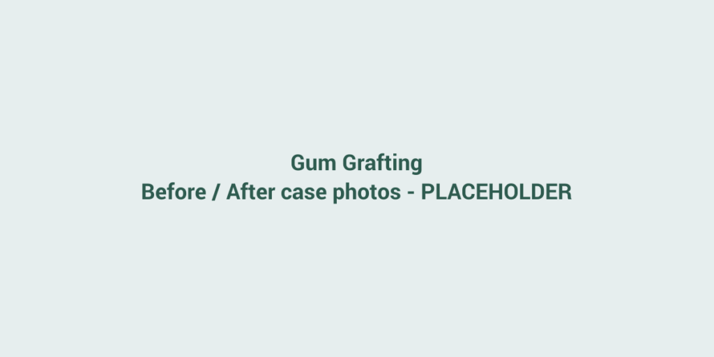 Placeholder for before and after case photos